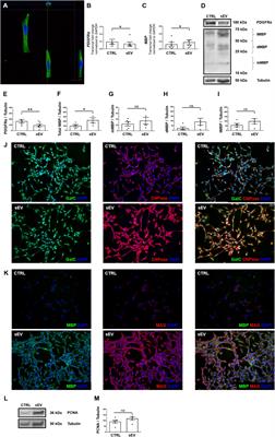 Human Wharton’s Jelly Mesenchymal Stromal Cell-Derived Small Extracellular Vesicles Drive Oligodendroglial Maturation by Restraining MAPK/ERK and Notch Signaling Pathways